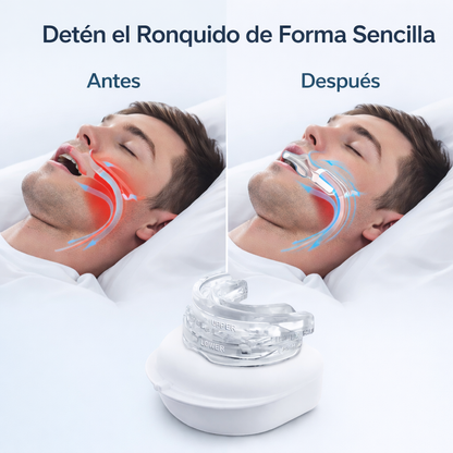 DIFINEY® Antirronquidos Alineador Mandibular