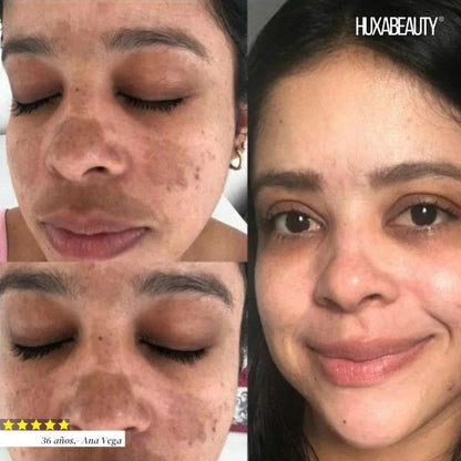 Sérum aclarador Bio-Exfoliante Inteligente🧬+