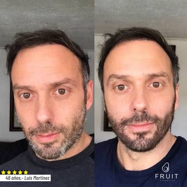 FRUIT® Tinte Natural con Aplicador | Cobertura Total en 5 Minutos