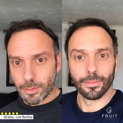 FRUIT® Tinte Natural con Aplicador | Cobertura Total en 5 Minutos