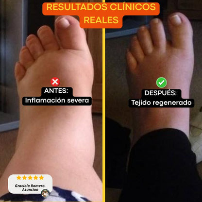 Fascitol™ - Tratamiento Clínico Eliminador de Fascitis Plantar
