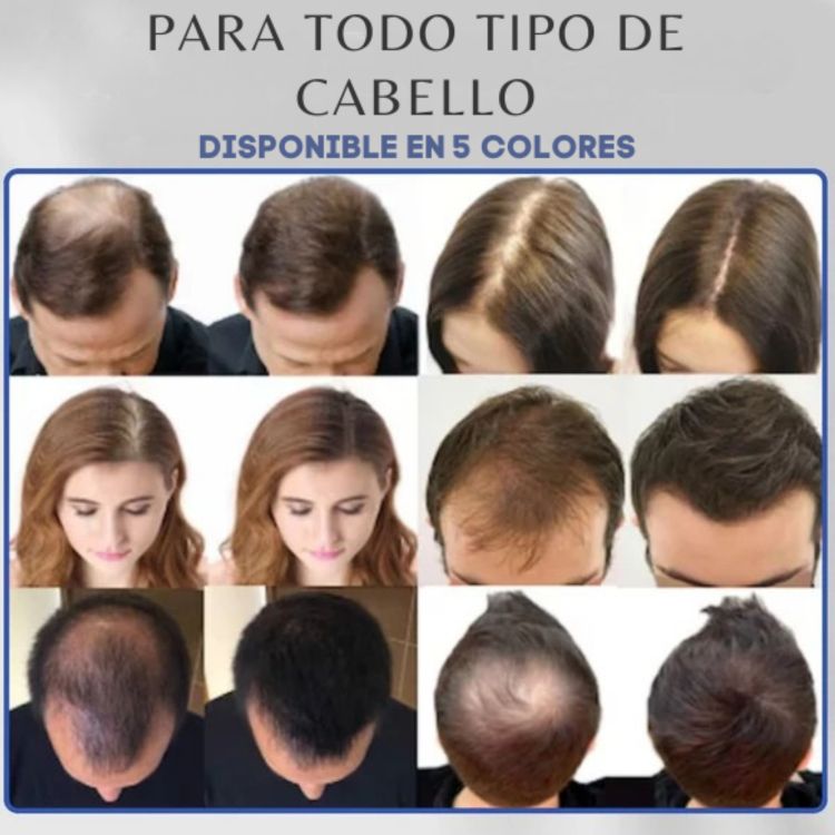 Toppik™ - Tratamiento de Crecimiento Capilar Natural (HOY 2X1)🎁