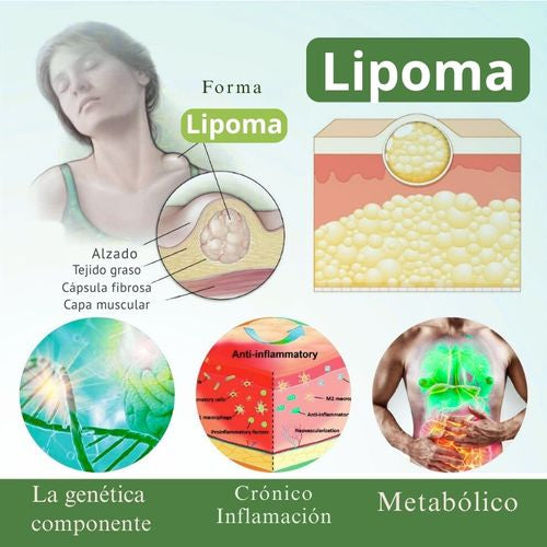 LipoClear™ nuevo Tratamiento eliminador de LIPOMAS
