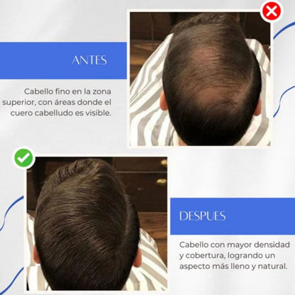 Toppik™ - Tratamiento de Crecimiento Capilar Natural (HOY 2X1)🎁