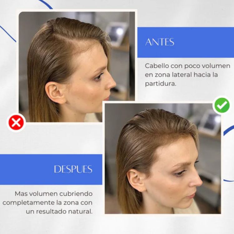Toppik™ - Tratamiento de Crecimiento Capilar Natural (HOY 2X1)🎁