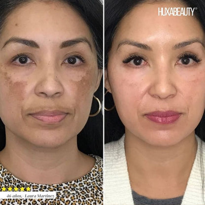 Sérum aclarador Bio-Exfoliante Inteligente🧬+