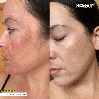 Sérum aclarador Bio-Exfoliante Inteligente🧬+
