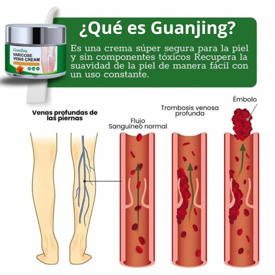 GuanJing® - Tratamiento Natural Eliminador de Varices